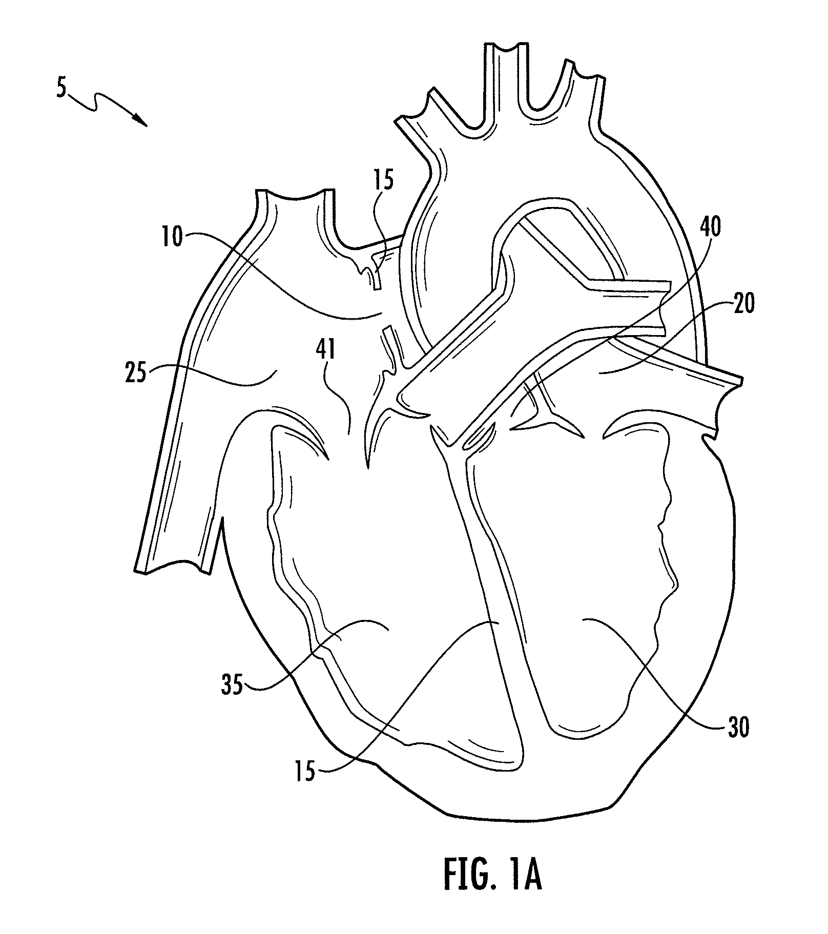 Device and method for occluding a septal defect
