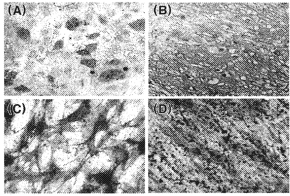 Adult stem cell line introduced with hepatocyte growth factor gene and neurogenic transcription factor gene with basic helix-loop-helix motif and uses thereof