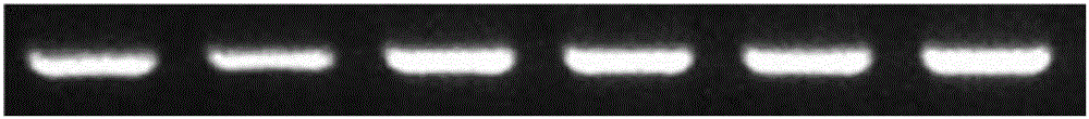 PCA3 mRNA/ACPP mRNA RT-PCR detection primer and detection kit thereof