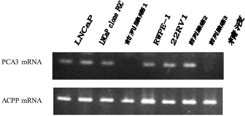 PCA3 mRNA/ACPP mRNA RT-PCR detection primer and detection kit thereof