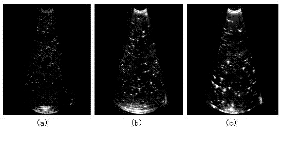 Measurement method for low sand content based on B-type ultrasound imaging technology