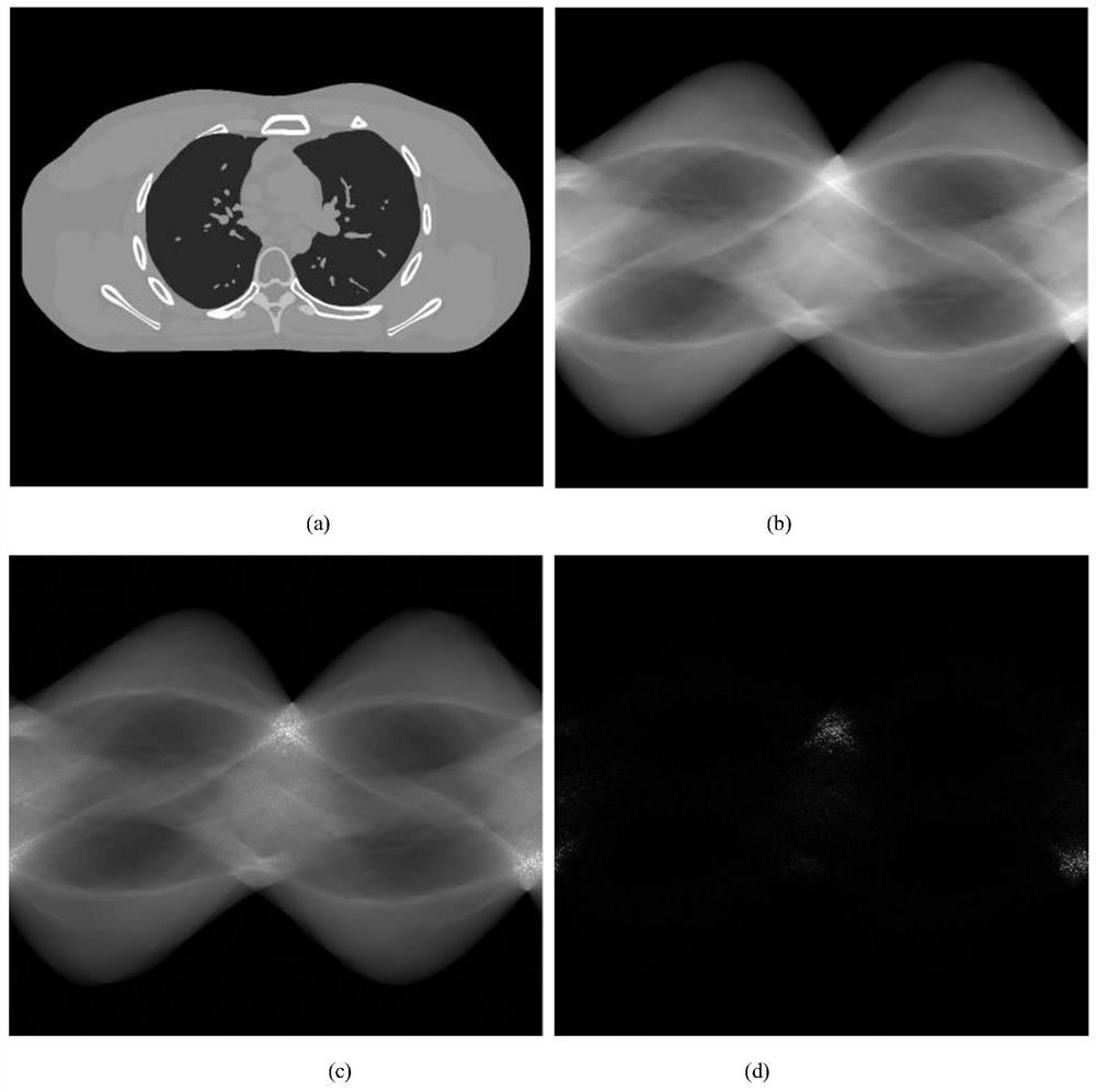 Low-dose CT projection domain denoising method based on composite regularization