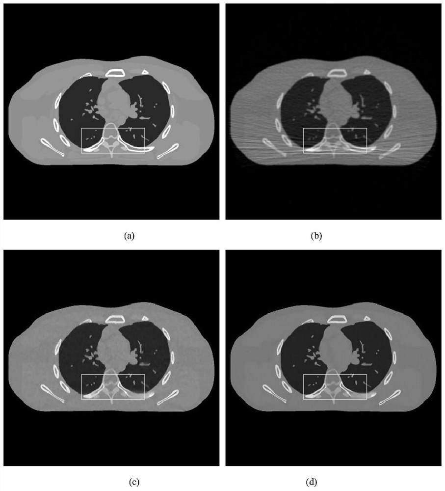 Low-dose CT projection domain denoising method based on composite regularization