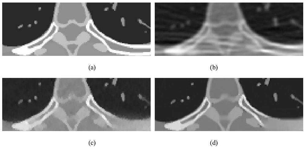 Low-dose CT projection domain denoising method based on composite regularization