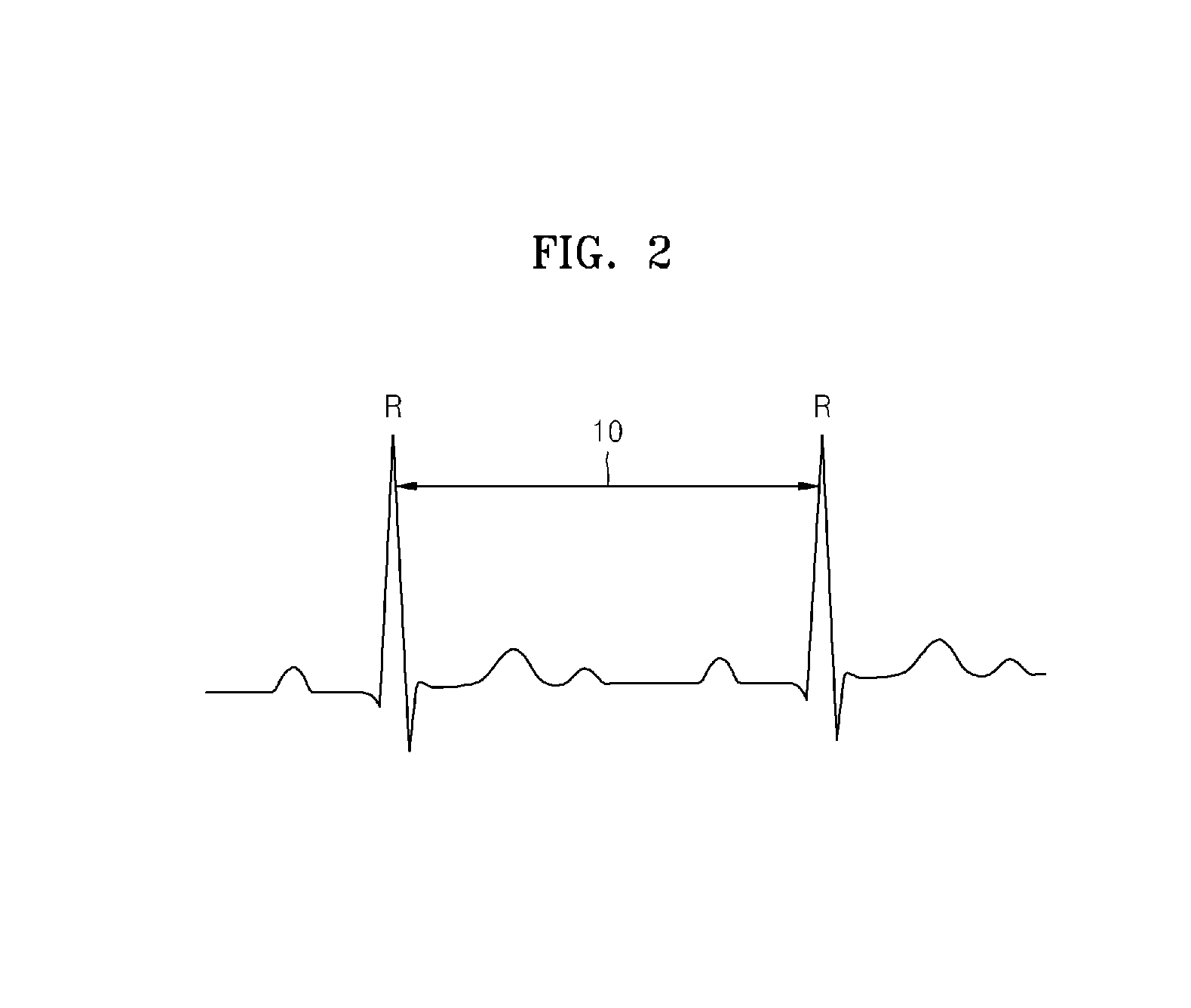 Method and apparatus for controlling load shedding in data stream management system