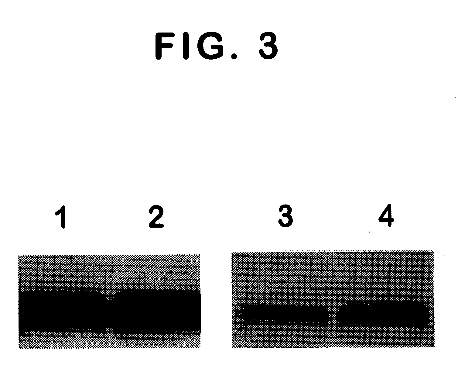 Monoclonal antibody specific for the extracellular domain of prostate specific membrane antigen