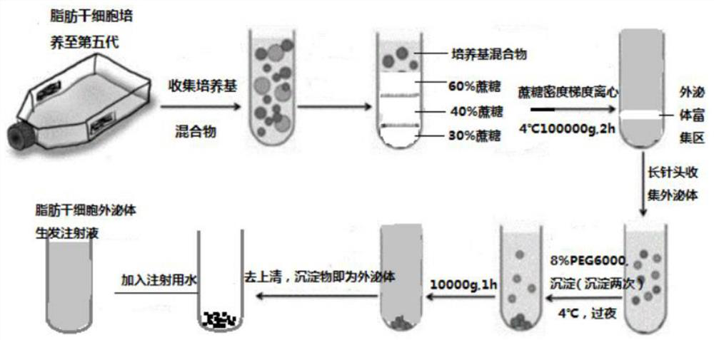 Hair growth injection solution based on autologous fat stem cell exosome, and preparation method