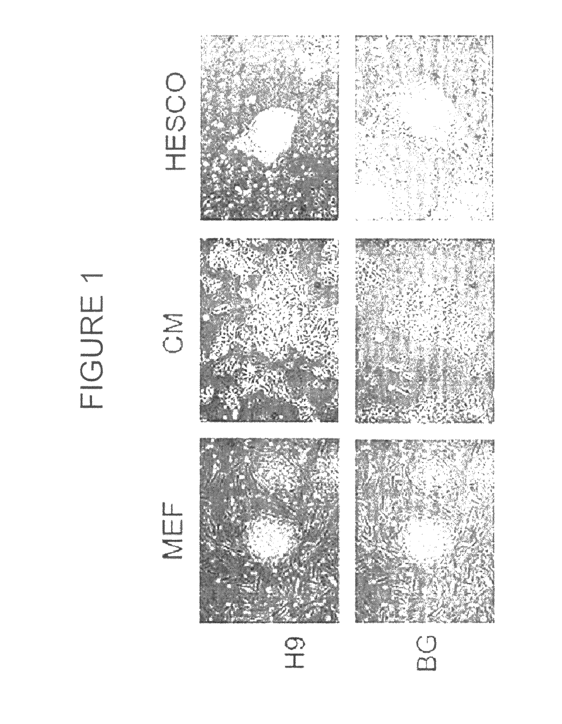 Defined Culture Conditions of Human Embryonic Stem Cells