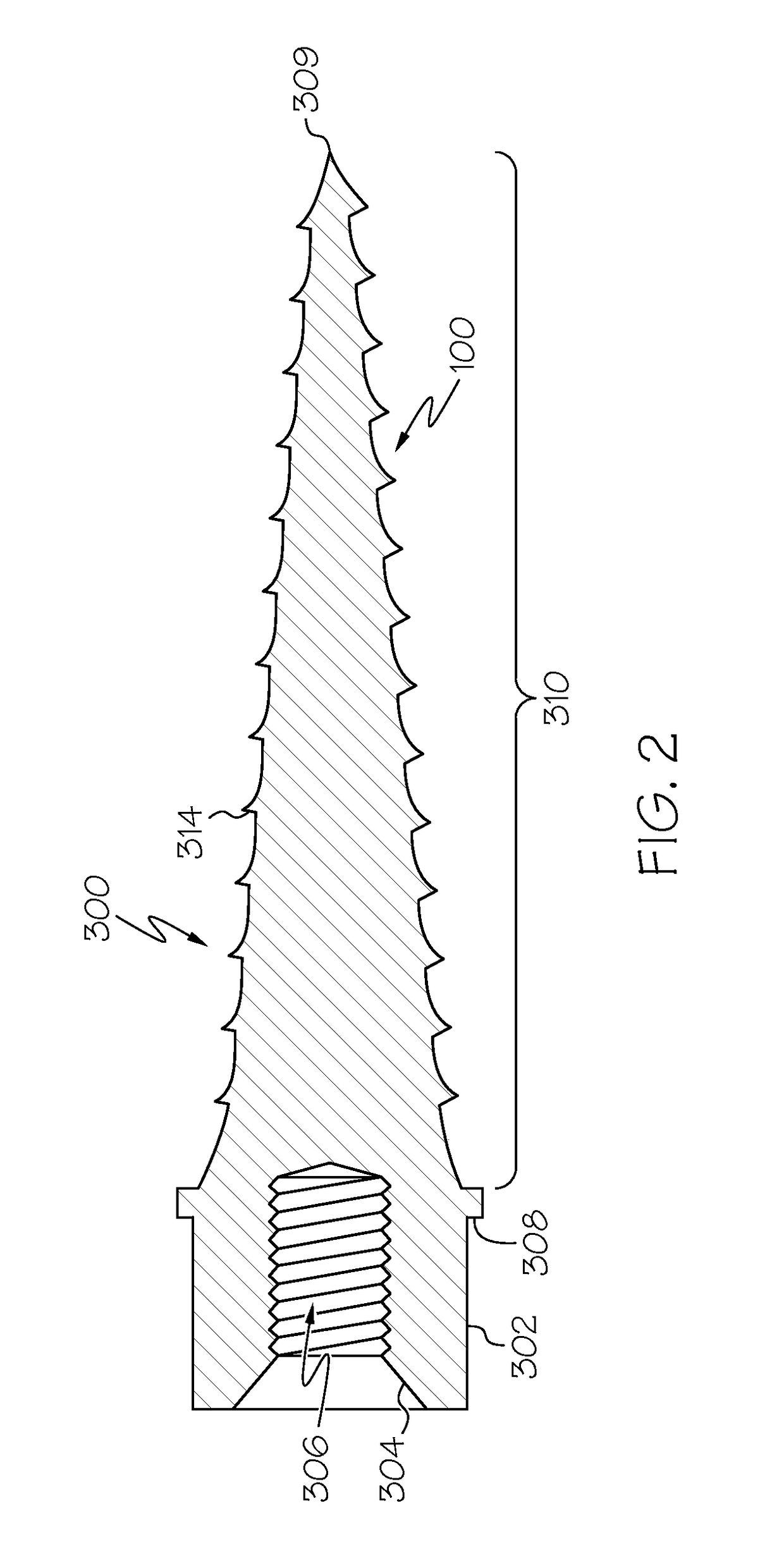 Hybrid temporary anchorage device implant system and associated methods