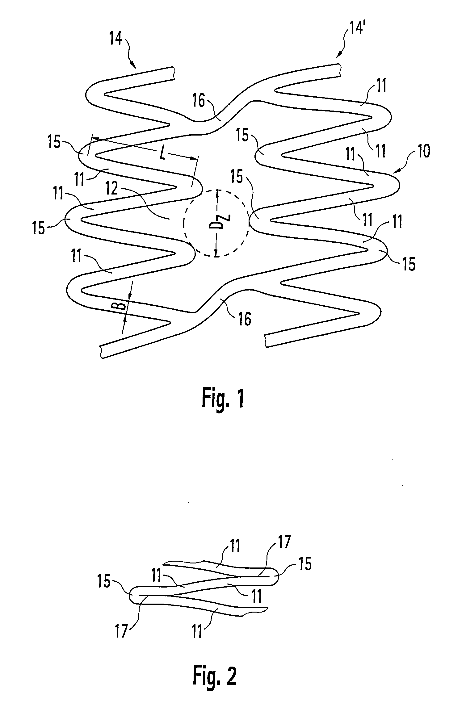 Stent and method for producing a stent