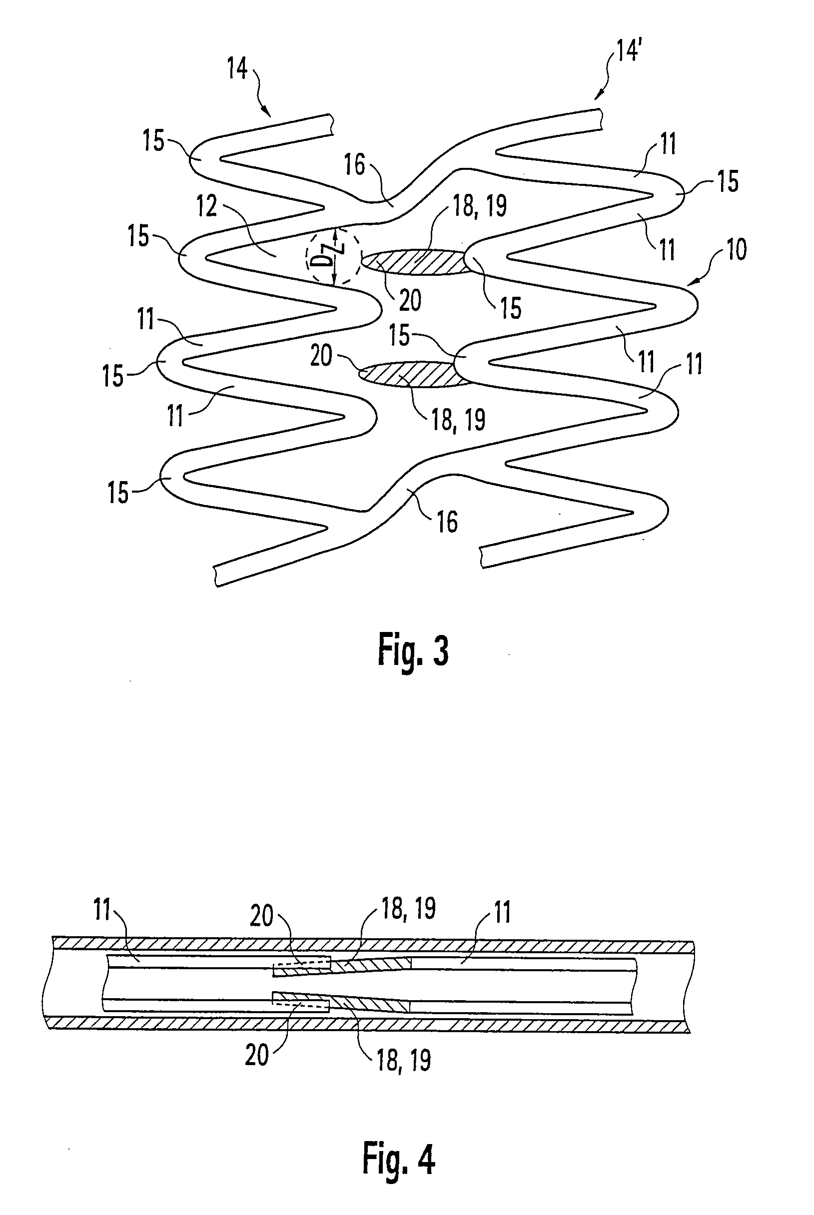 Stent and method for producing a stent