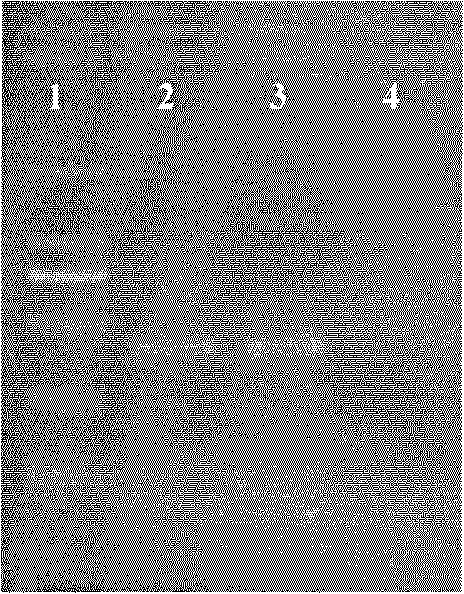 PCR (Polymerase Chain Reaction) detection kit for cystic echinococcosis of dog