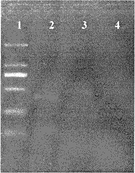 PCR (Polymerase Chain Reaction) detection kit for cystic echinococcosis of dog