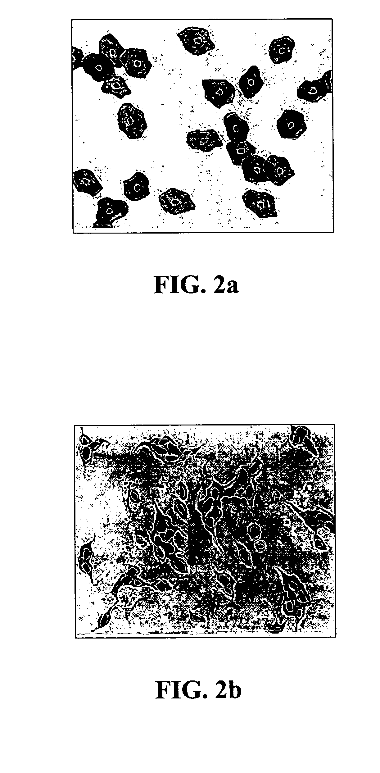 Method and apparatus for automated analysis of biological specimen