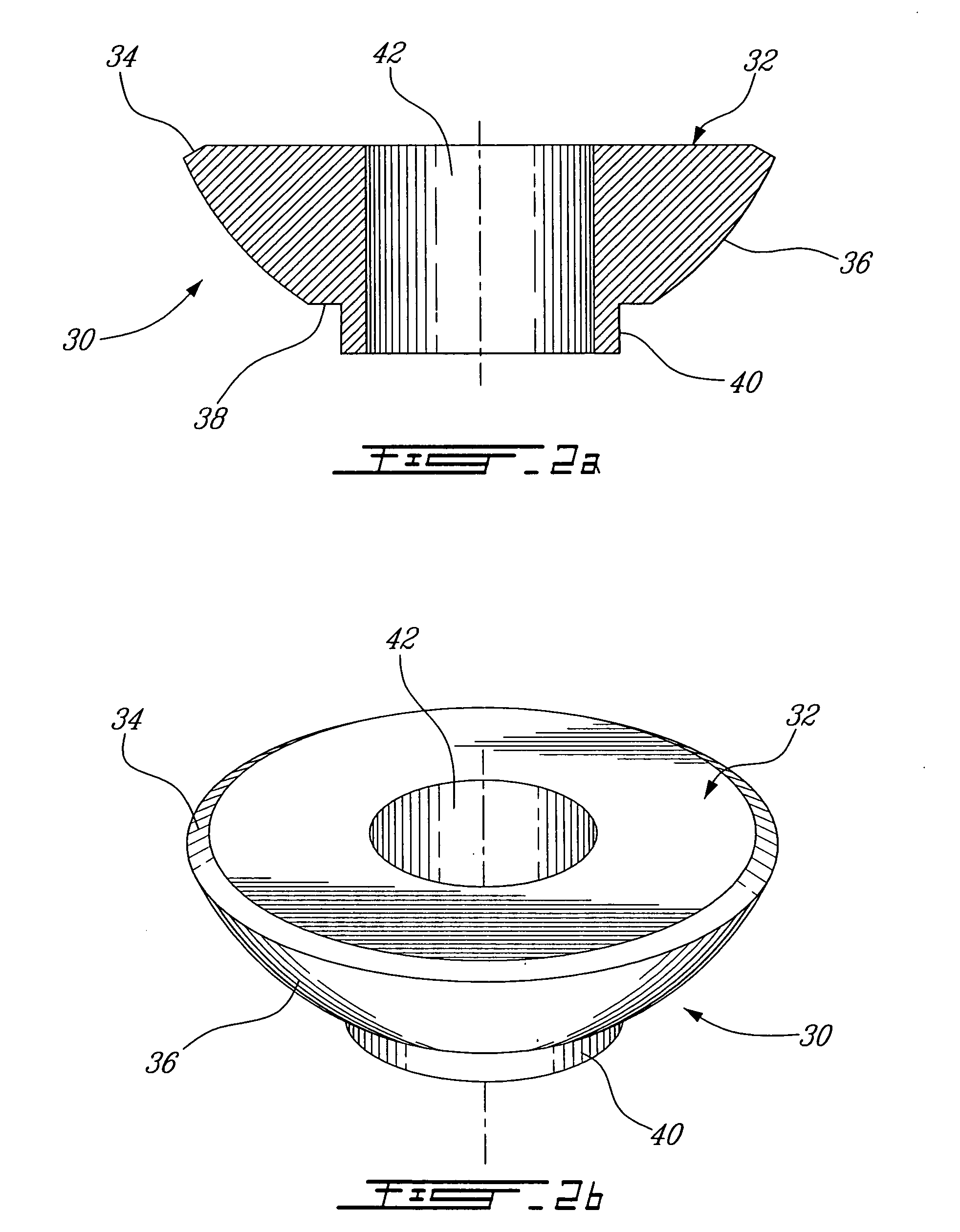 Implant system and method of installation thereof