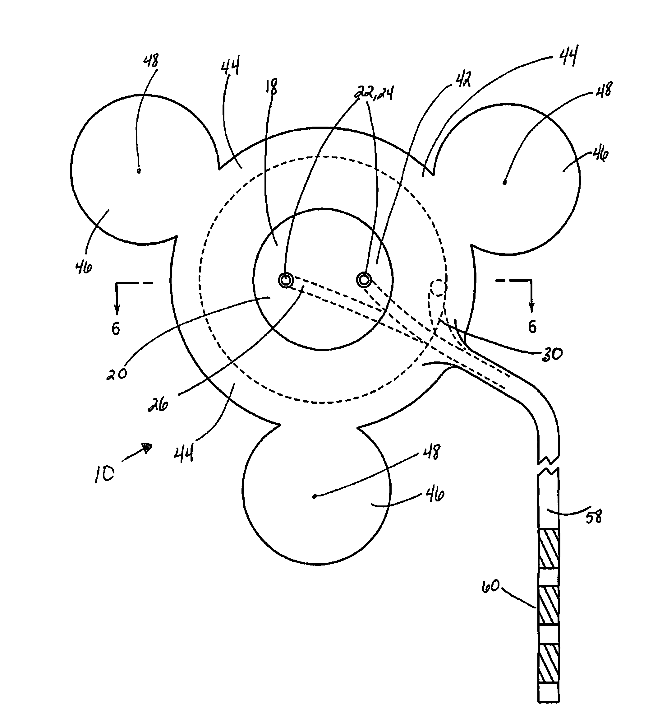 Intracranial sensing & monitoring device with macro and micro electrodes