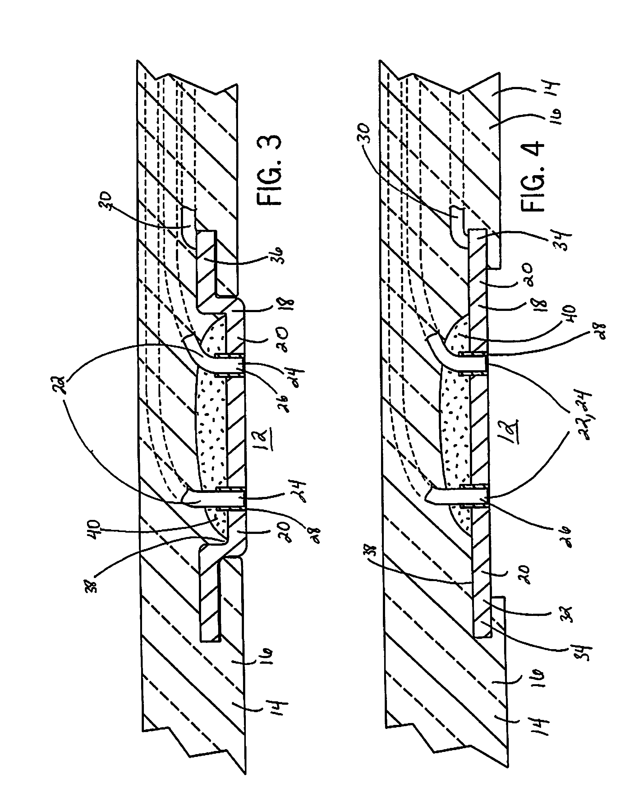 Intracranial sensing & monitoring device with macro and micro electrodes