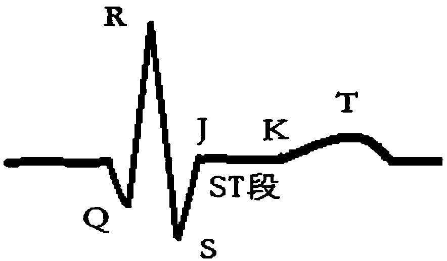 Electrocardiosignal ST section automatic judging method and device based on artificial intelligent technology