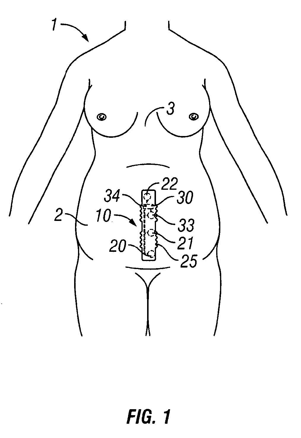 Disposable fetal monitor patch