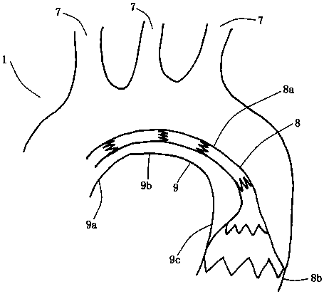 Aortic arch and branch covered stent blood vessel combined device for open operation