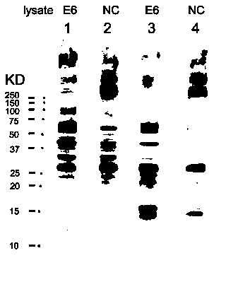 HPV58E6 specificity rabbit monoclonal antibody as well as preparation method and application thereof