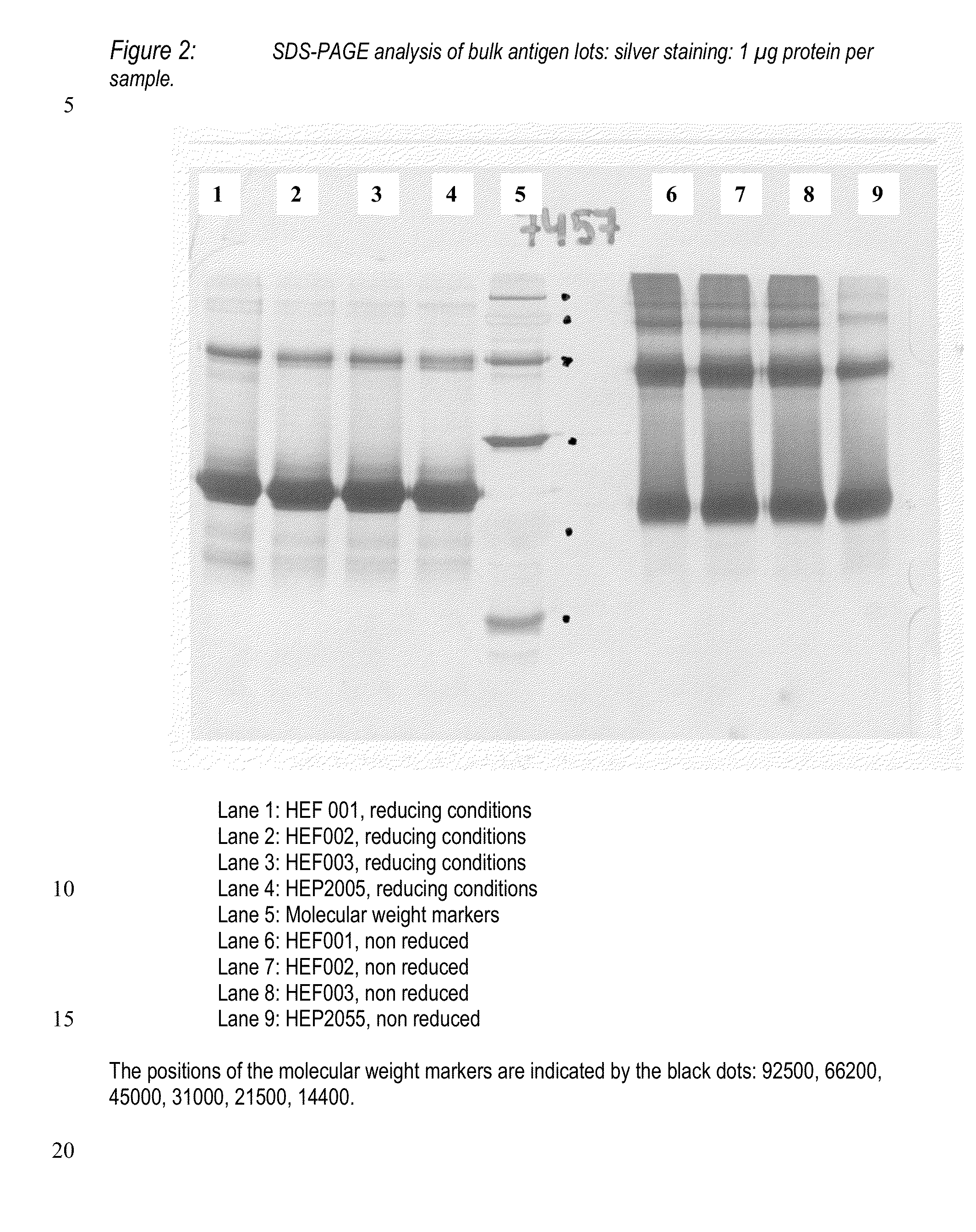 Purification of HBV antigens for use in vaccines