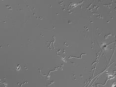 Streptomyces A2 strain with strong bacteriostatic effect and application thereof