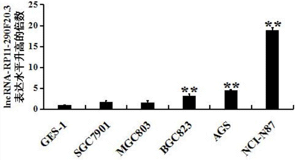 Applications of lncRNA-RP11-290F20.3 and small interfering RNA of lncRNA-RP11-290F20.3
