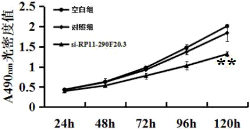 Applications of lncRNA-RP11-290F20.3 and small interfering RNA of lncRNA-RP11-290F20.3