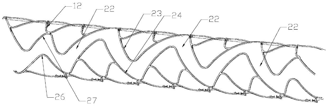 Thrombectomy screen frame and thrombectomy device