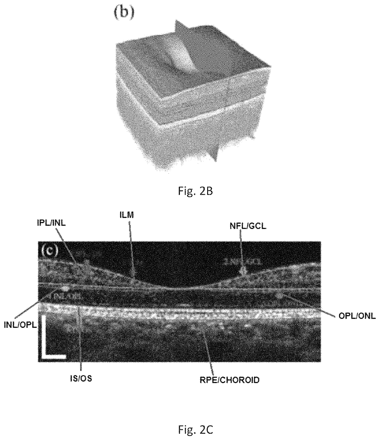 Automatic three-dimensional segmentation method for OCT and doppler OCT angiography
