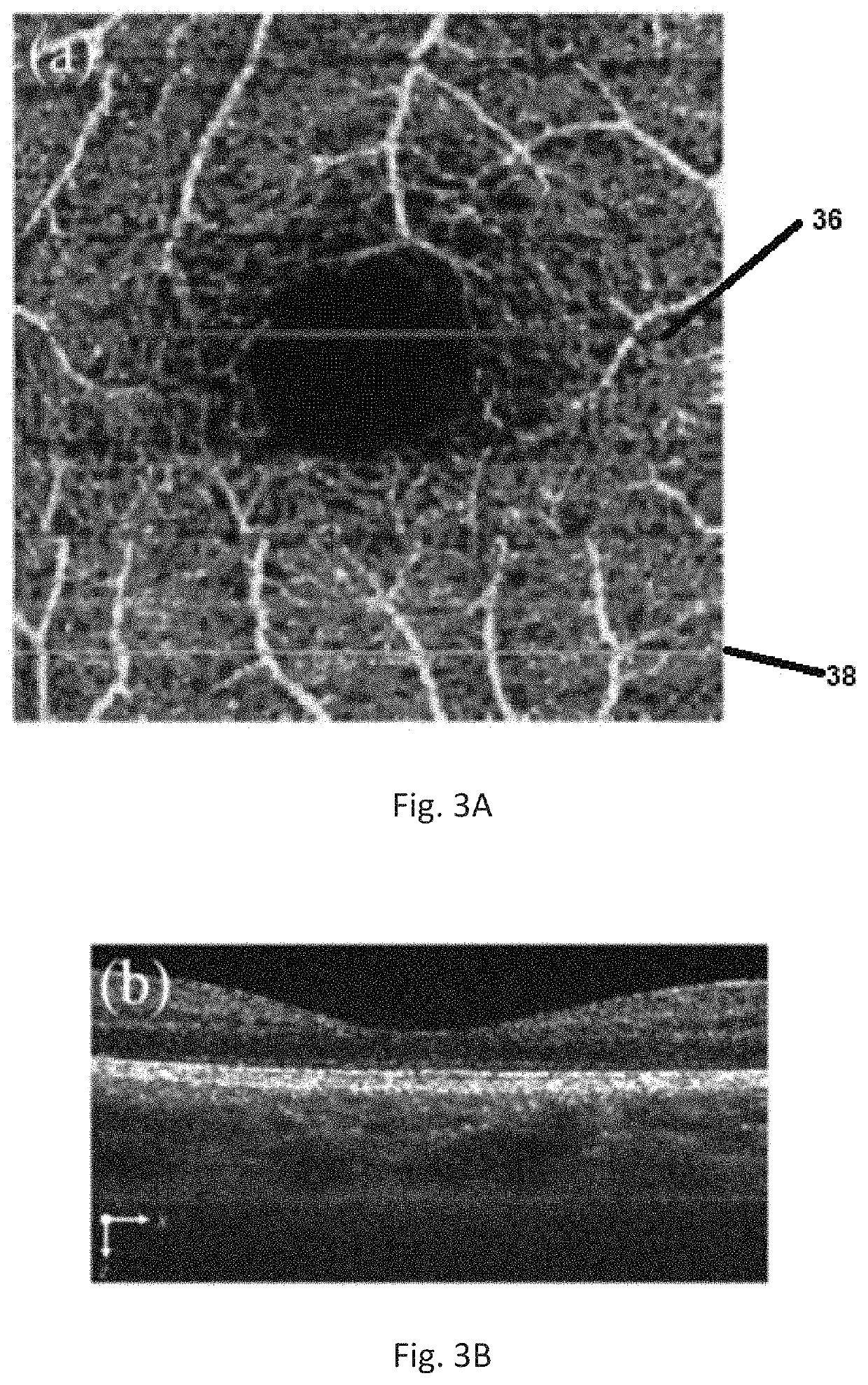 Automatic three-dimensional segmentation method for OCT and doppler OCT angiography