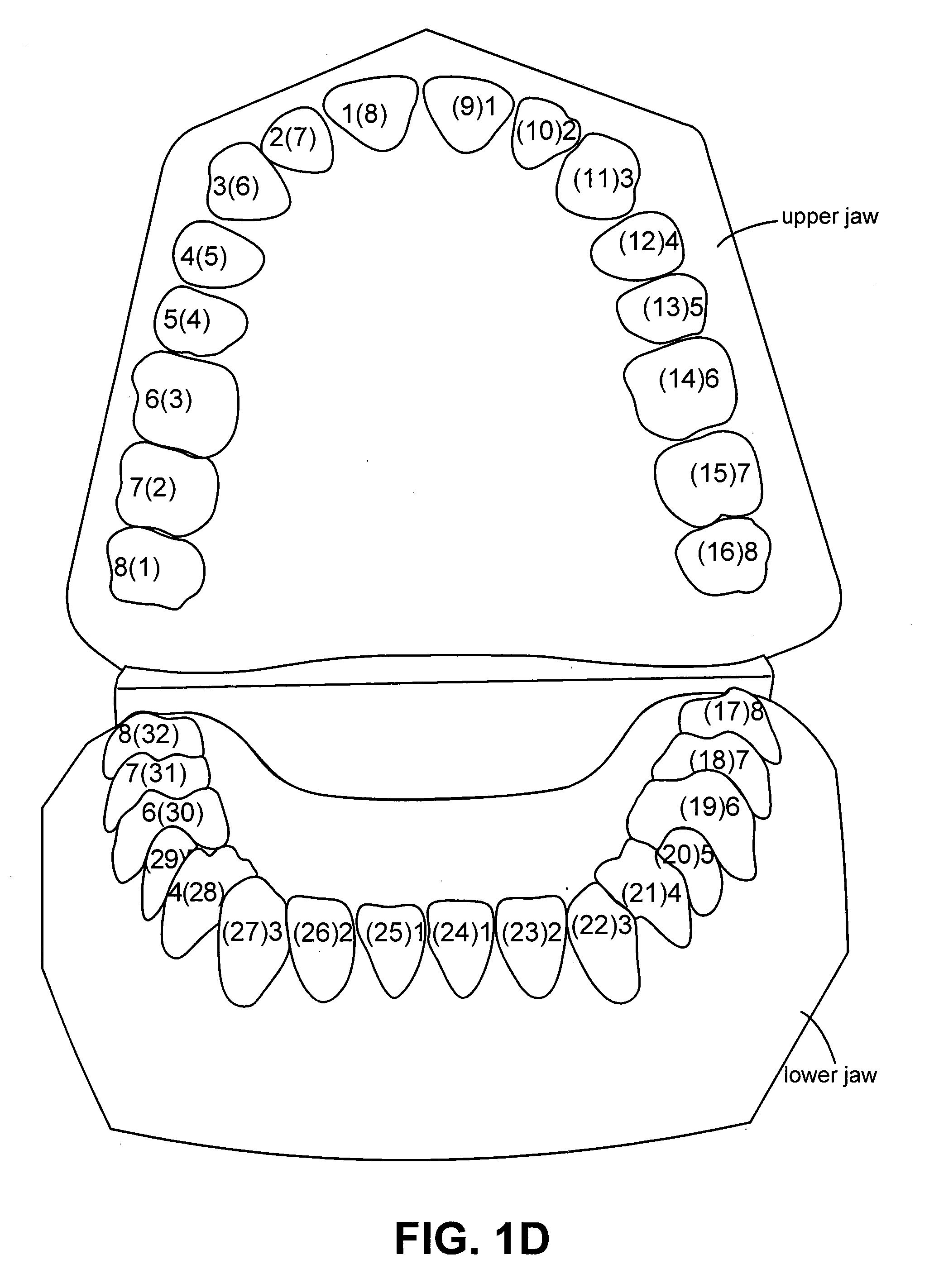 System and method for positioning three-dimensional brackets on teeth