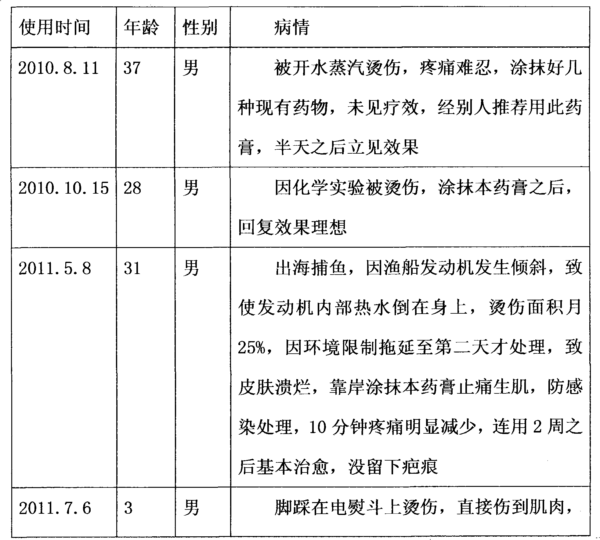 External ointment for treating scalds and preparation method thereof