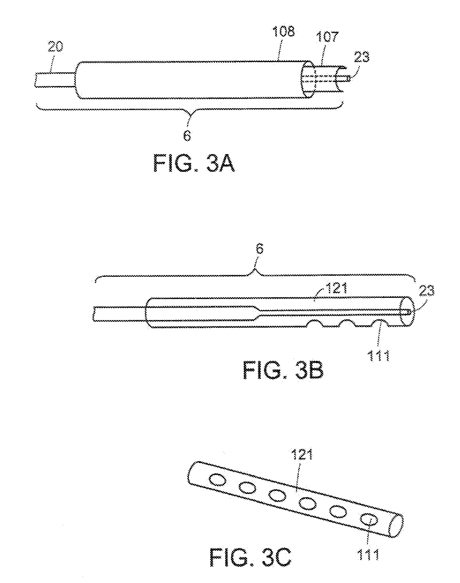 Apparatus and method of removing occlusions using ultrasonic medical device operating in a transverse mode