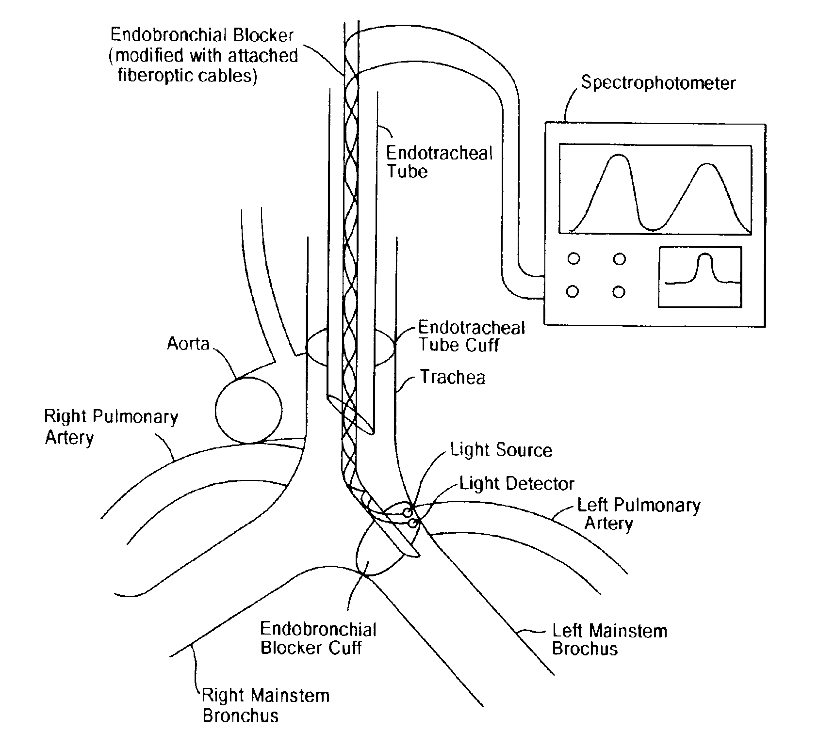 Transbronchial reflectance oximetric measurement of mixed venous oxygen saturation, and device therefor