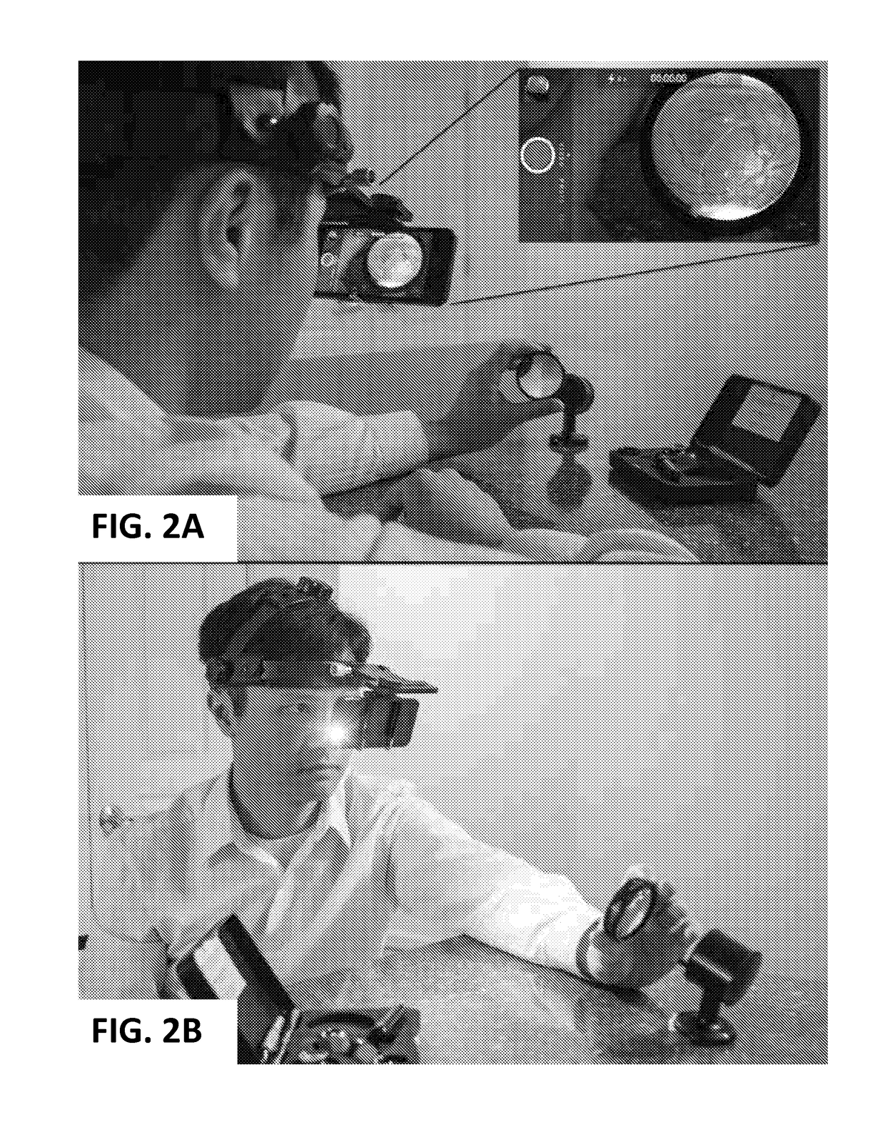 Head-mounted indirect opthalmoscope camera