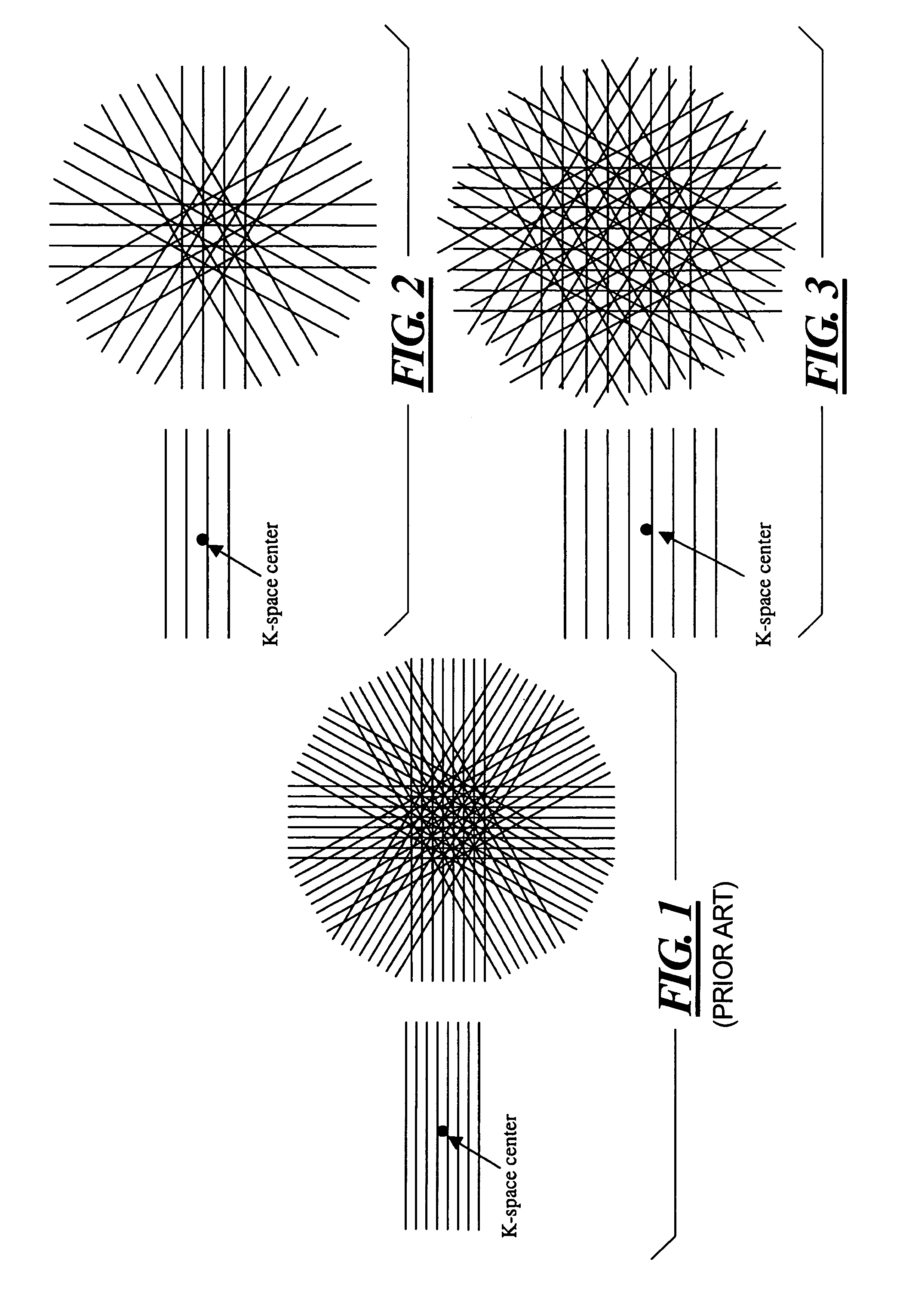 MRI method and apparatus for faster data acquisition or better motion artifact reduction