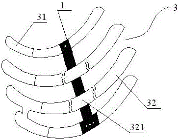 Flail Chest Treatment Device