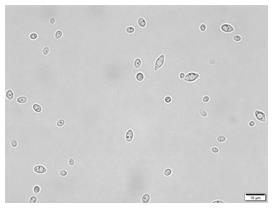 Hansenula anomala MP261 capable of inhibiting phytopathogen and application of hansenula anomala MP261
