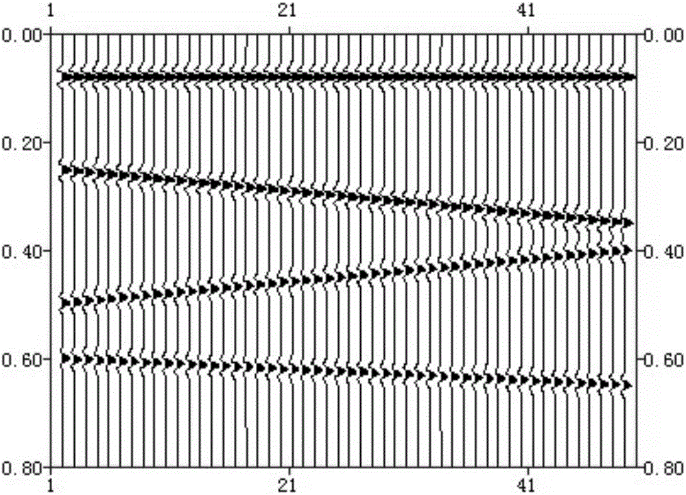 Random noise suppression method and apparatus for seismic data