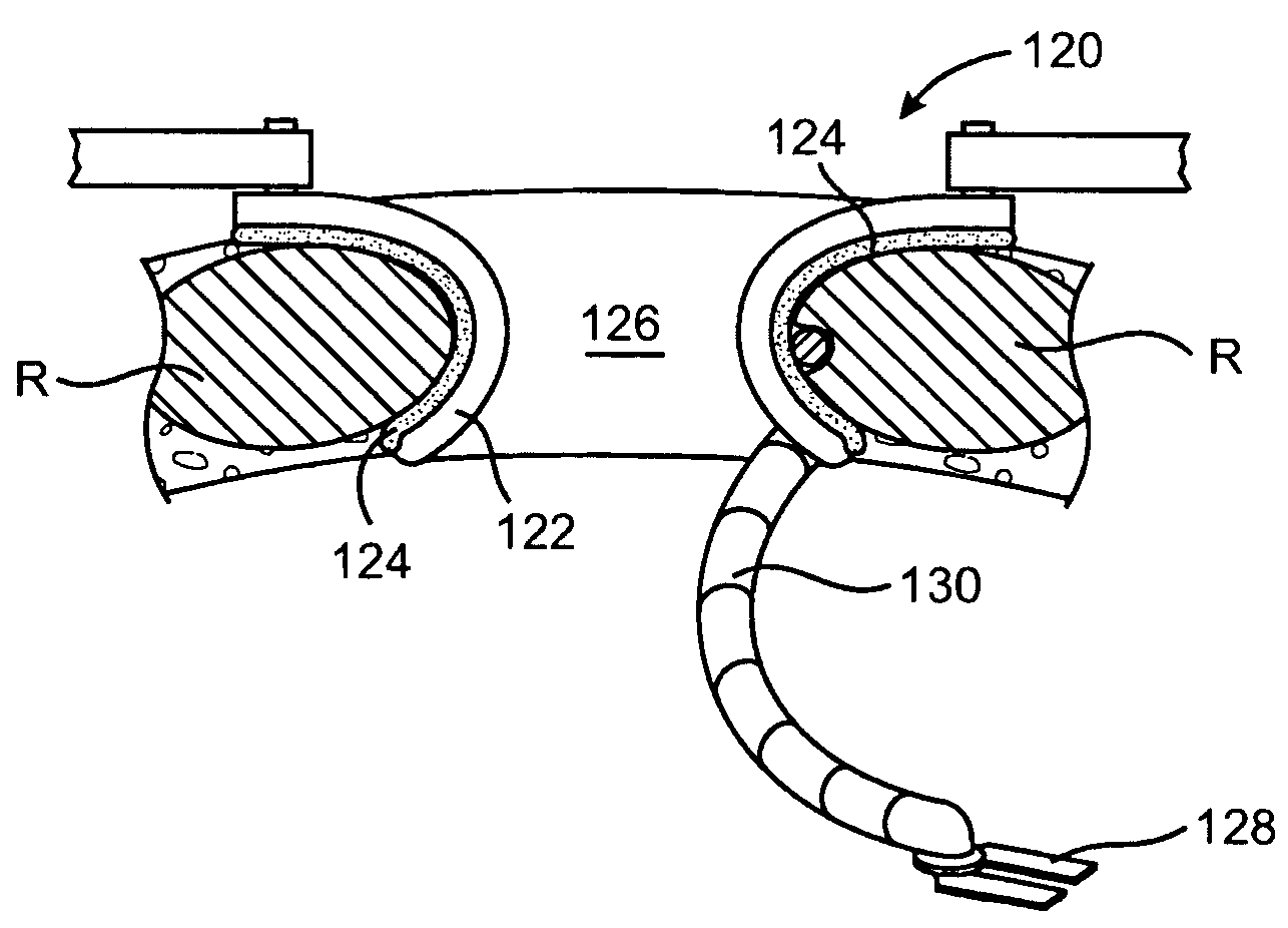 Retractor with inflatable blades