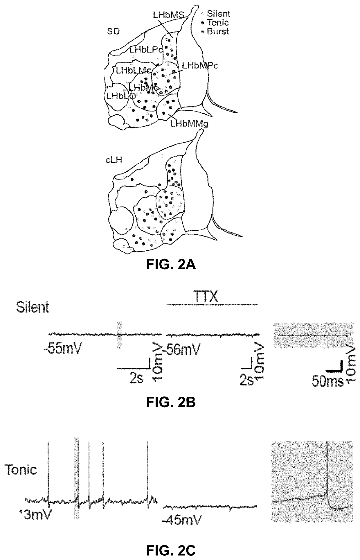 Method and pharmaceutical composition for treating depression