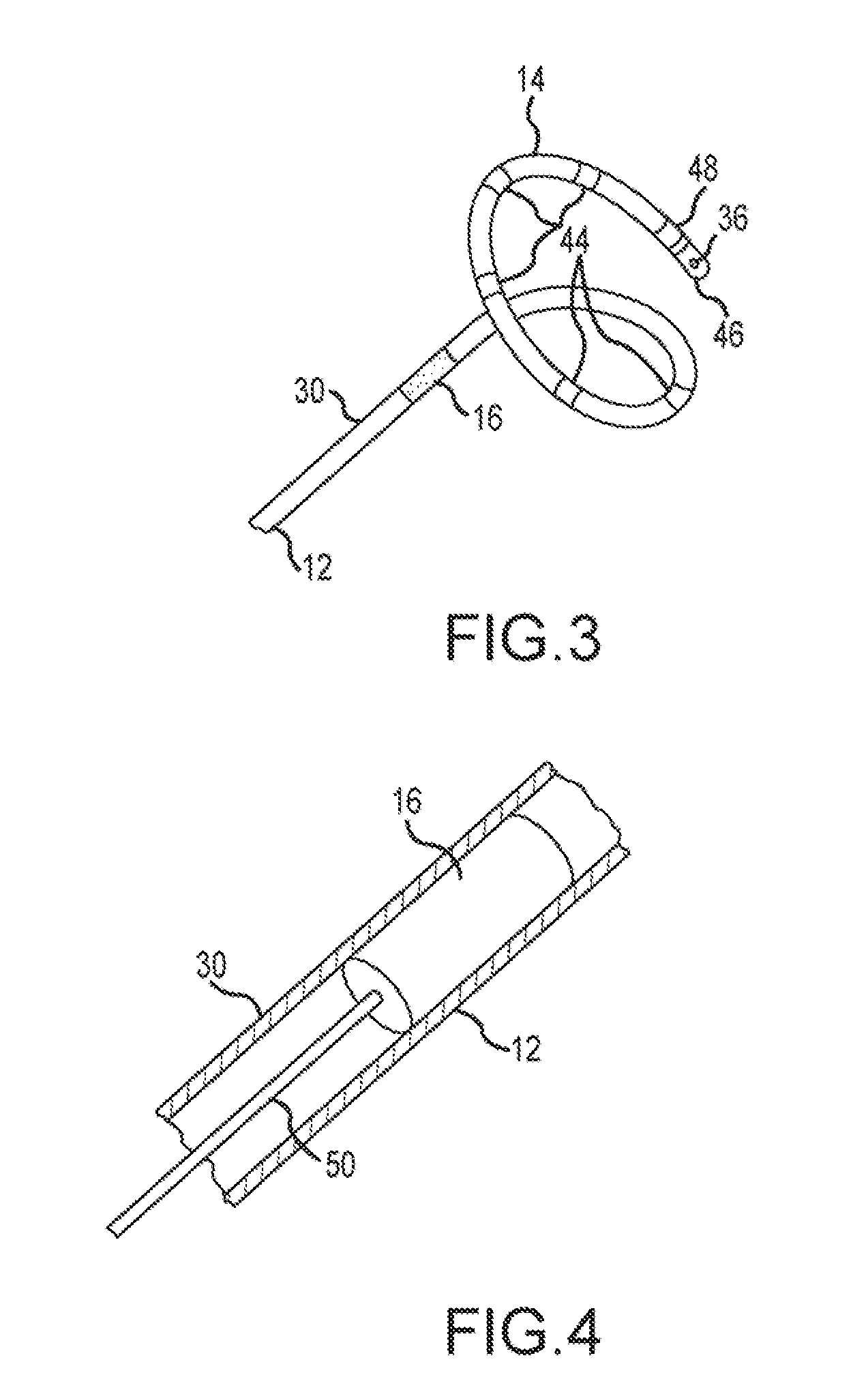 Movable magnet for magnetically guided catheter