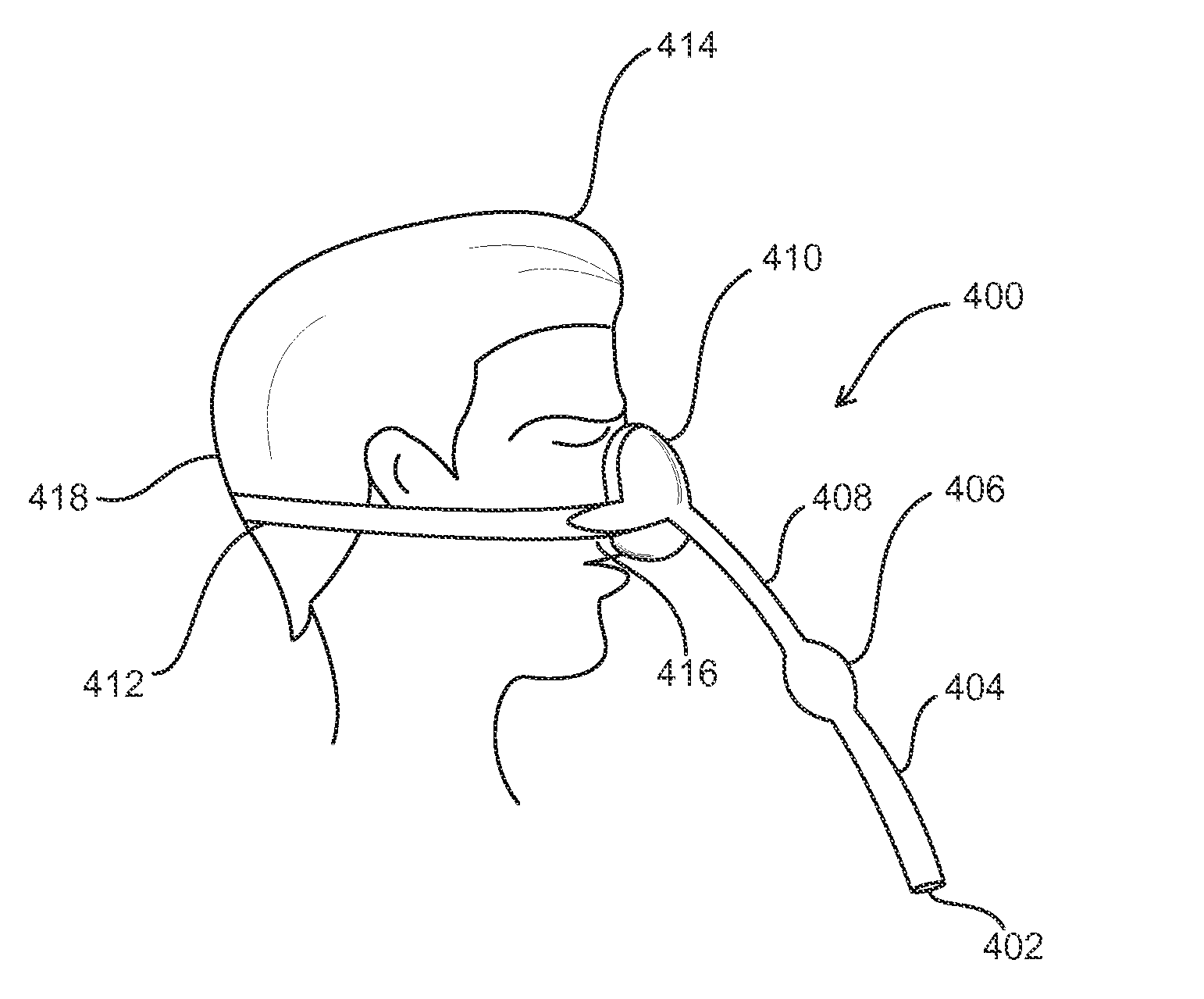 Systems and methods for providing positive airway pressure in a tube-like structure