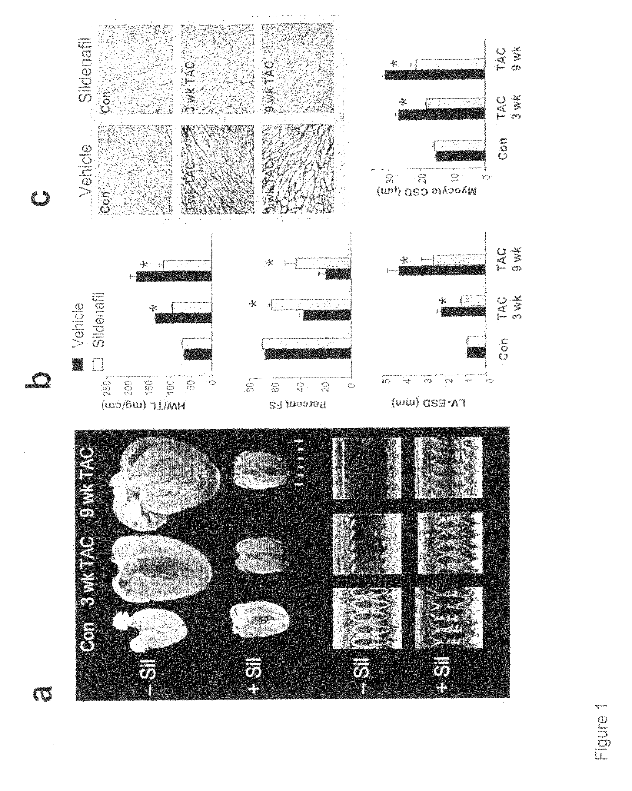 PDE5 inhibitor compositions and methods for treating cardiac indications