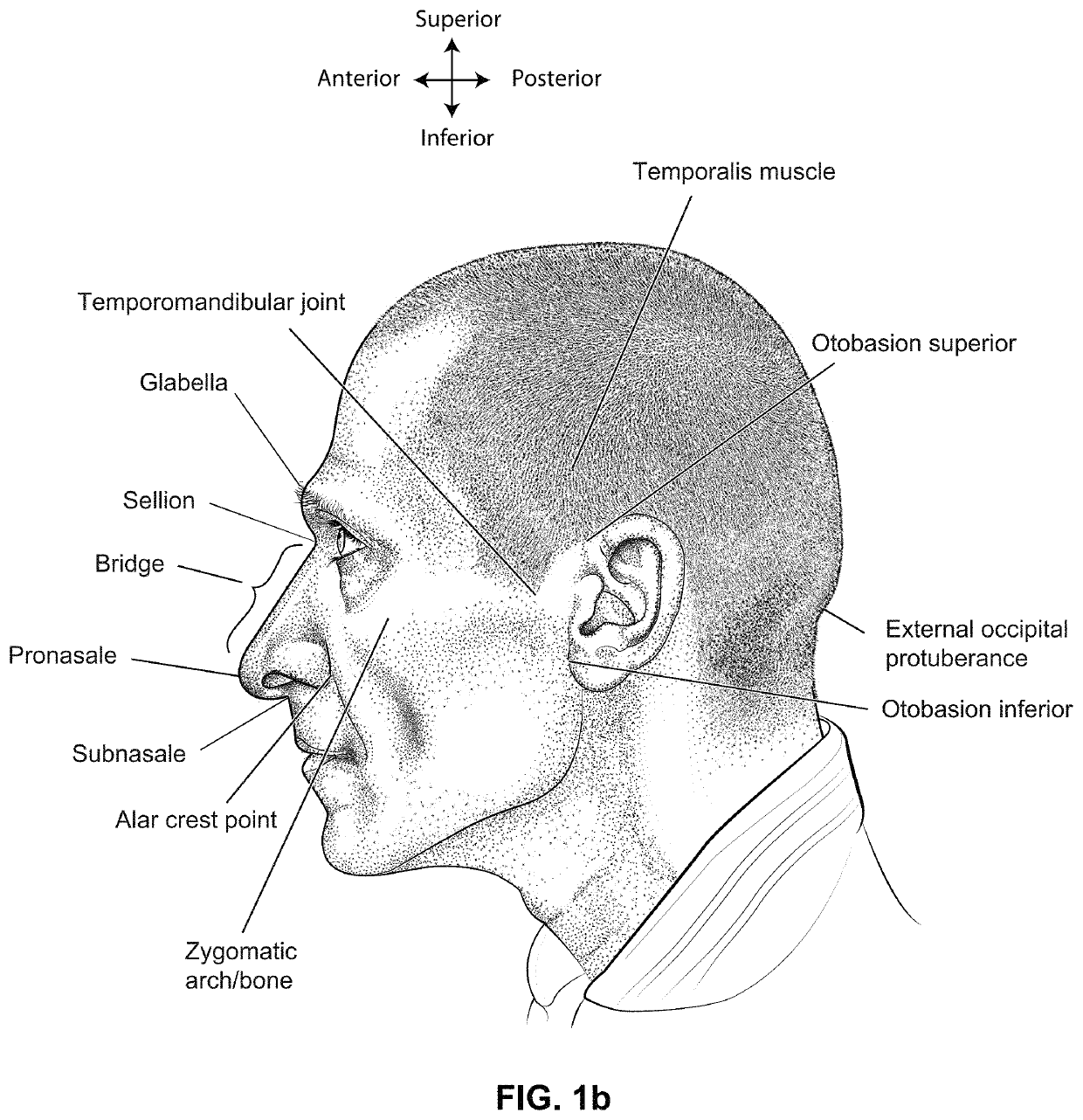 Positioning, stabilising, and interfacing structures and system incorporating same