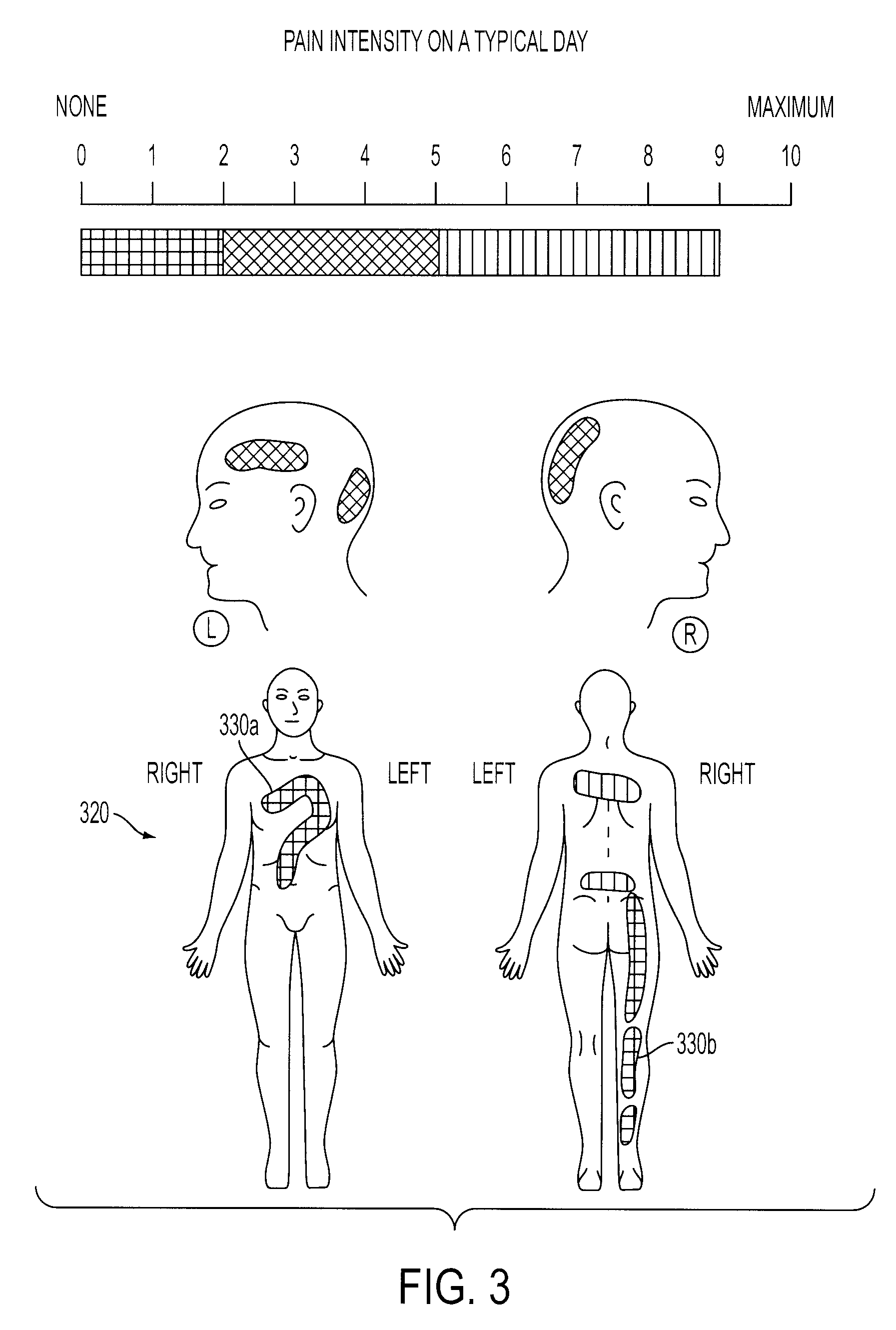 System And Method For Mapping Pain Depth