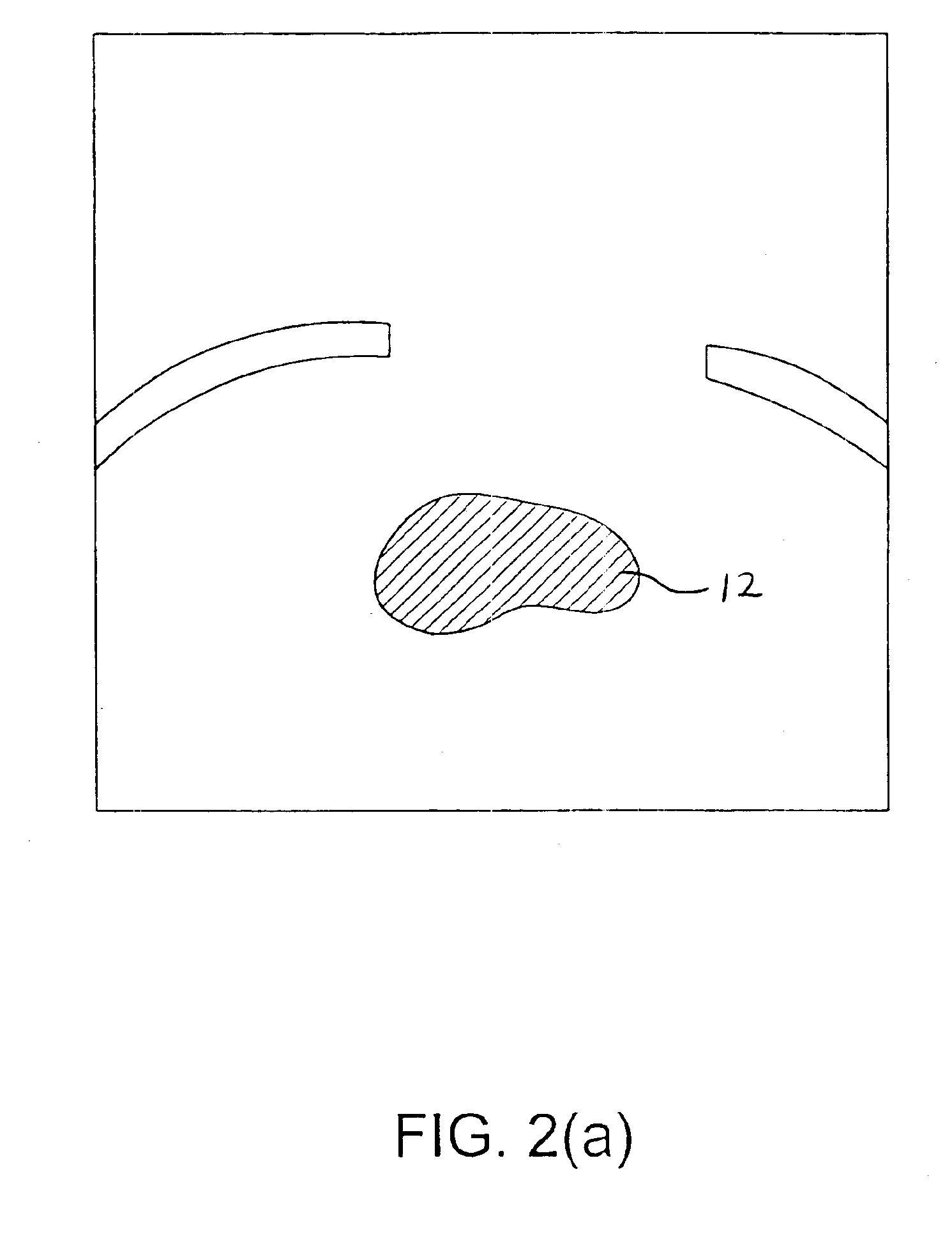 Method of treating a tumor by pre-irradiation