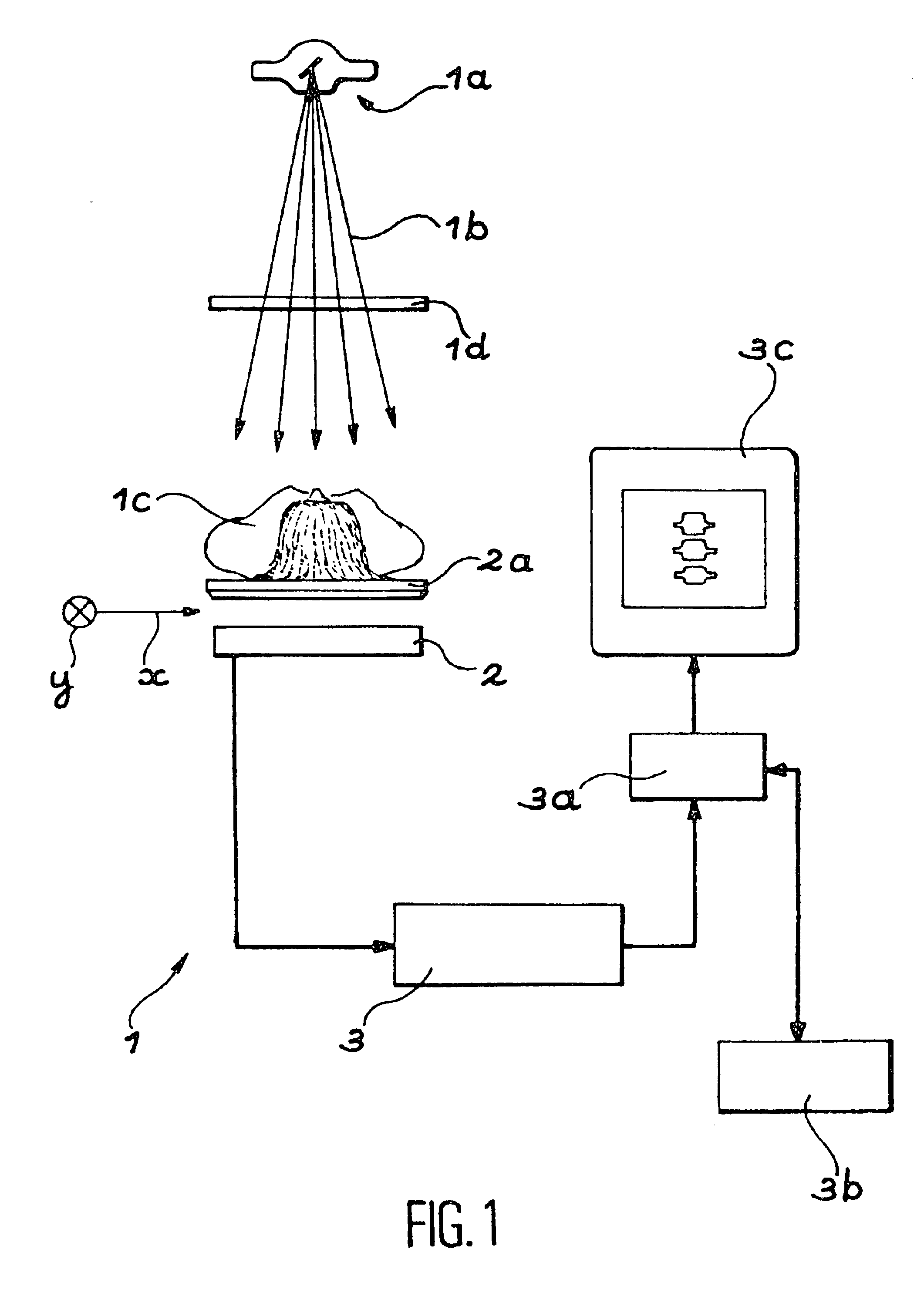 Method for using a bone densitometry system, with dual-energy x-radiation